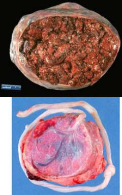 此图足月妊娠胎盘的大体图,下述哪项是错误的()
